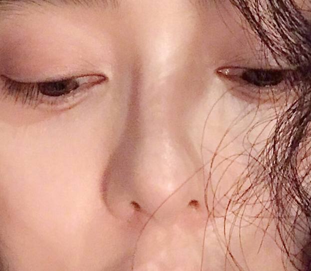 Phạm Băng Băng bị nghi gãy mũi do phẫu thuật thẩm mỹ - 3