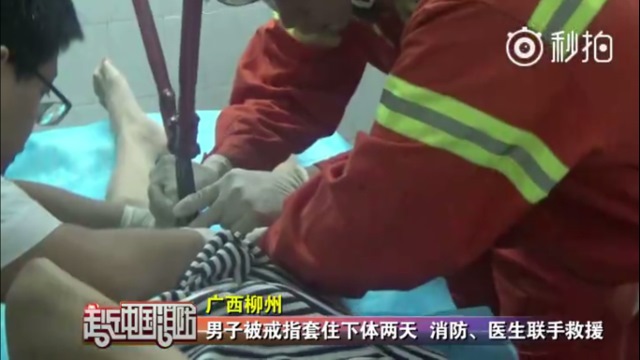 Thanh niên khốn khổ vì tự dưng đeo nhẫn vào “của quý” - 2