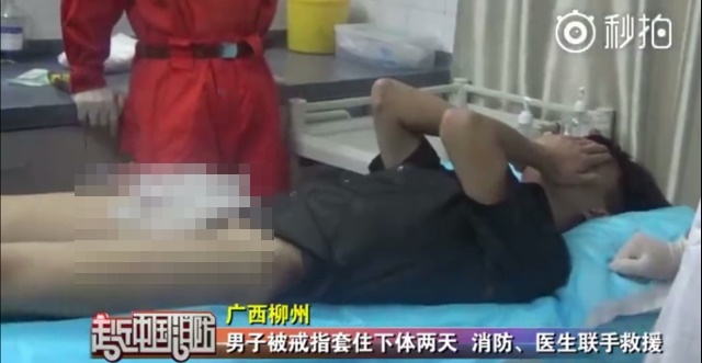 Thanh niên khốn khổ vì tự dưng đeo nhẫn vào “của quý” - 3