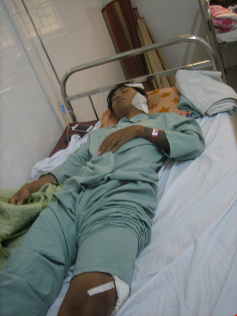 Đang ngồi chơi bị nhóm côn đồ lao vào chém tới tấp - 1