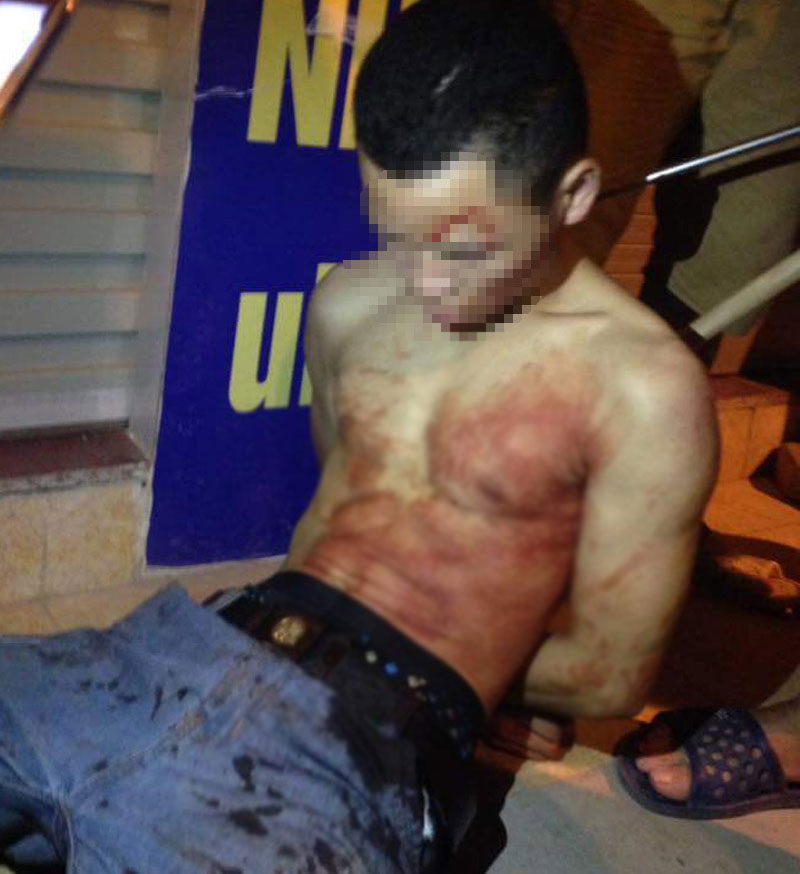 Lái xe taxi bị đâm vào cổ lao ra đường kêu cứu - 2