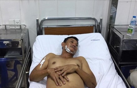 Côn đồ ngáo đá đâm chạm phổi hàng xóm - 1