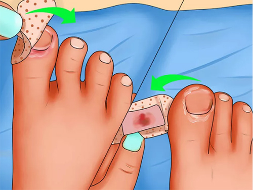 Để móng chân khỏe đẹp, hãy thực hiện 4 nguyên tắc này - 2