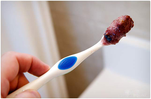 Khắc phục hàm răng ố vàng với 3 giải pháp tự nhiên - 5