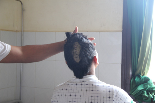 Đang chơi bida, bị côn đồ lao vào chém tới tấp - 1