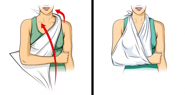 Những kỹ năng cứu người đơn giản nhưng ai cũng cần phải biết - 6