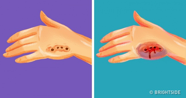 Những kỹ năng cứu người đơn giản nhưng ai cũng cần phải biết - 5