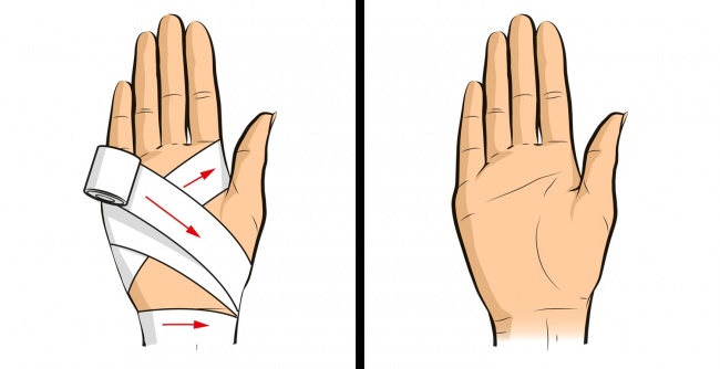 Những kỹ năng cứu người đơn giản nhưng ai cũng cần phải biết - 9