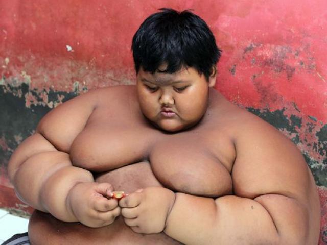 Cậu bé béo nhất thế giới nặng gần 2 tạ "đổi đời" vì giảm cân