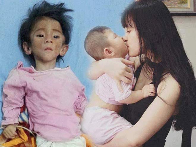 Cô gái nhận nuôi em bé suy dinh dưỡng: "Lấy chồng vẫn đưa con theo" - 1