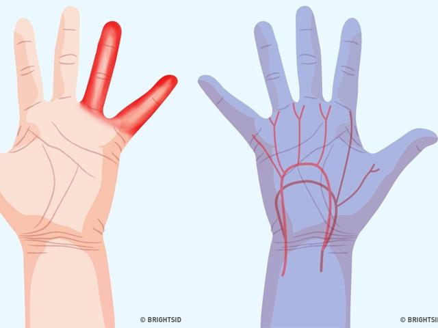 Đau bụng kèm theo những dấu hiệu này, dè chừng nguy cơ mắc ... Đau bụng kèm theo những dấu hiệu này, dè chừng nguy cơ mắc ...