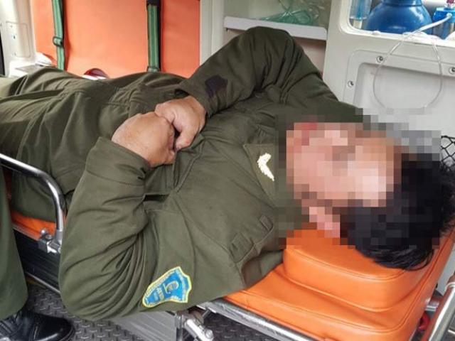 Đề nghị khởi tố ‘cò’ taxi đánh nhân viên sân bay Nội Bài gãy răng