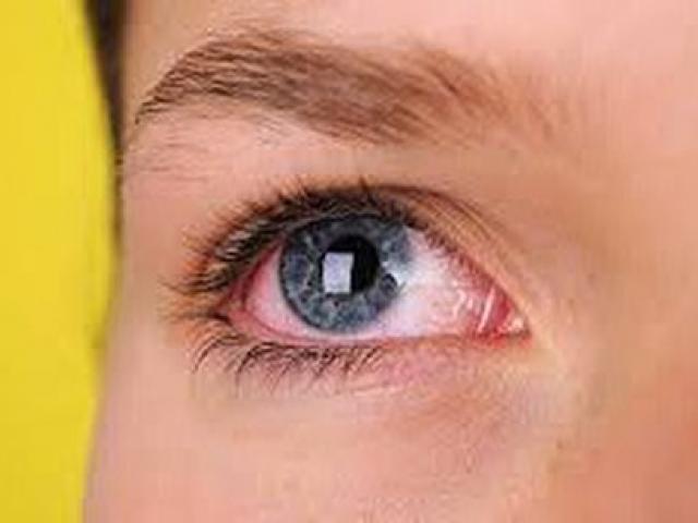 Bệnh gây mù lòa hàng đầu thế giới: Cứ 2 giây có 1 người không nhìn thấy ánh sáng