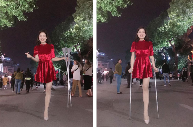 Cô gái mất 1 chân xuất hiện trên phố đi bộ Hà Nội gây xôn xao: Sau 4 ngày tỉnh lại đã thành người khác - 1