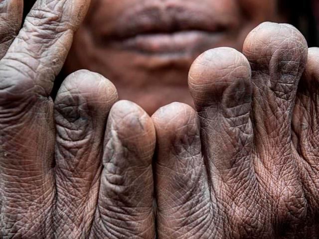 Kỳ lạ bộ lạc tự cắt ngón tay khi có người thân qua đời