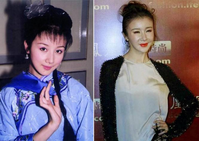 Những ‘thảm họa dao kéo’ của showbiz châu Á - 11