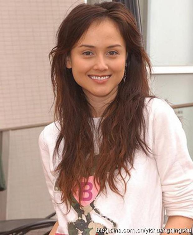 Những ‘thảm họa dao kéo’ của showbiz châu Á - 12