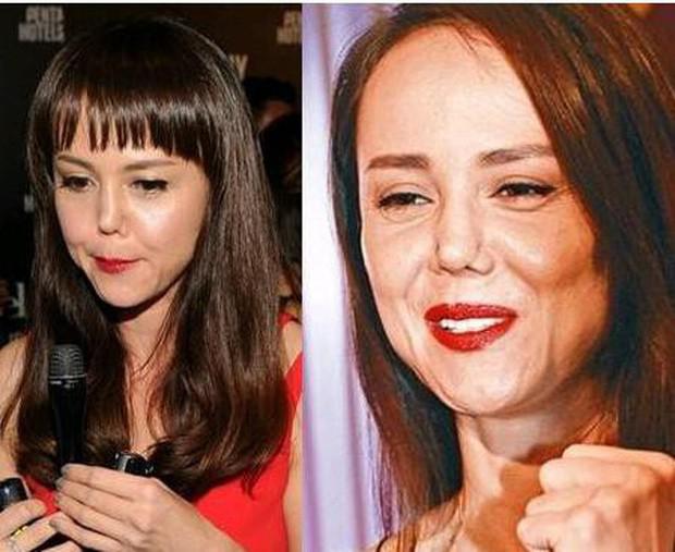 Những ‘thảm họa dao kéo’ của showbiz châu Á - 13