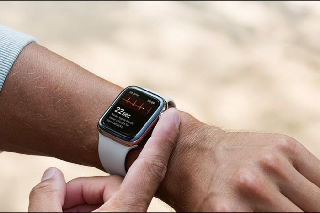 4 vấn đề sức khỏe Apple Watch có thể phát hiện, đừng quá tin tưởng - 1