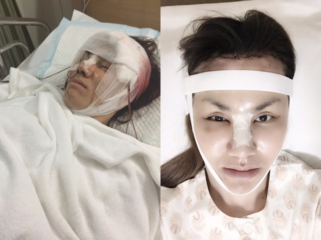 Chàng trai &#34;xấu đau xấu đớn&#34; trở thành cô gái xinh đẹp, cưới thiếu gia giàu có giờ ra sao? - 4