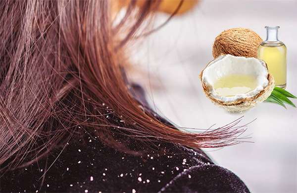 Cách sử dụng dầu dừa dưỡng tóc bóng khỏe hiệu quả nhất tại nhà - 2