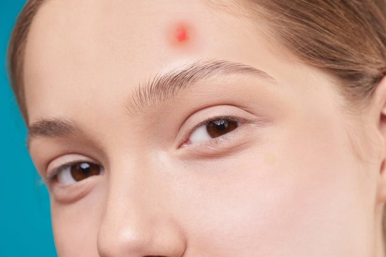 Có nên dùng kem đánh răng trị mụn? - 3