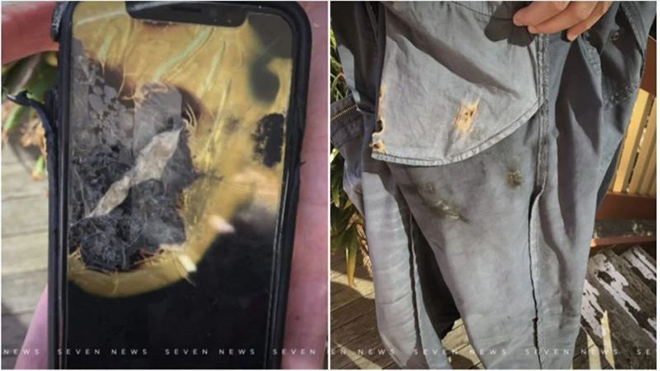 iPhone X phát nổ trong túi quần, gây bỏng cho người dùng - 1