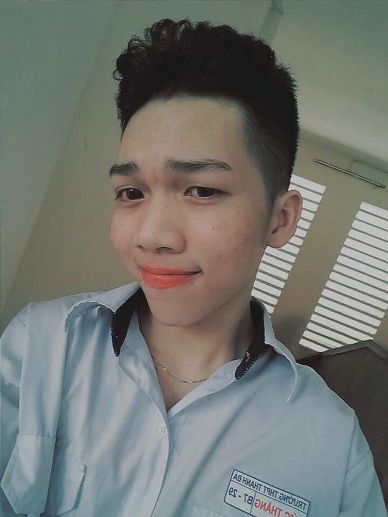 3 chàng trai Việt chi tiền tỷ để "đập mặt đi xây lại", đàn ông cũng “vịt bầu hoá thiên nga” - 4