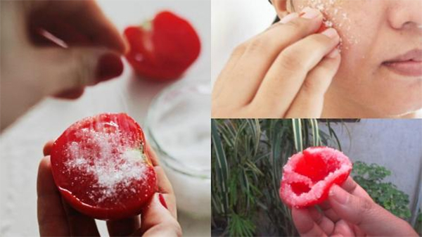 Top 15 loại mặt nạ cà chua giúp trị mụn trắng da an toàn hiệu quả tại nhà - 9