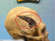 Dấu vết lạ trên hộp sọ chiến binh 2.000 năm tiết lộ khả năng kinh ngạc của người xưa