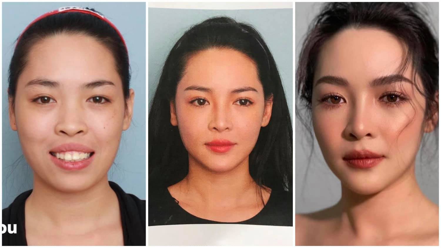 “Siêu phẩm thẩm mỹ Việt”: Đẹp như thần tiên tỷ tỷ nhưng ngại mở lòng - 3