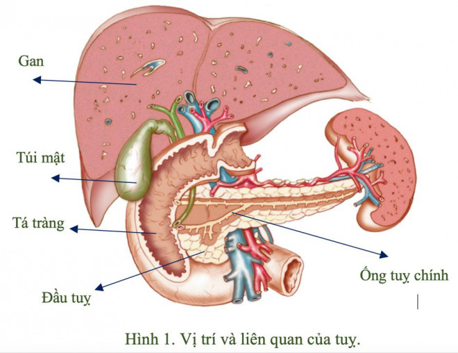 Sỏi tụy: Nguyên nhân, biểu hiện, biến chứng và điều trị - 1