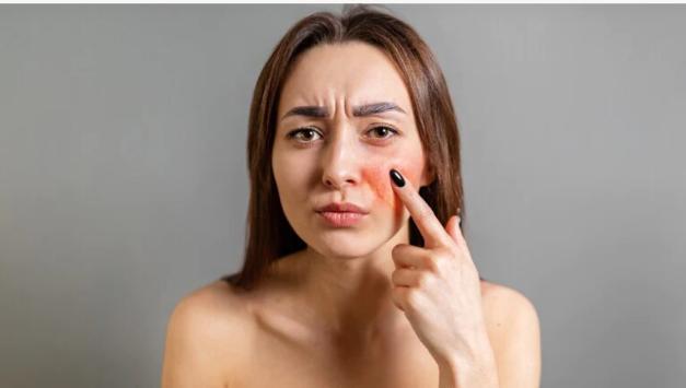 Bí quyết skincare dành cho da nhạy cảm - 1