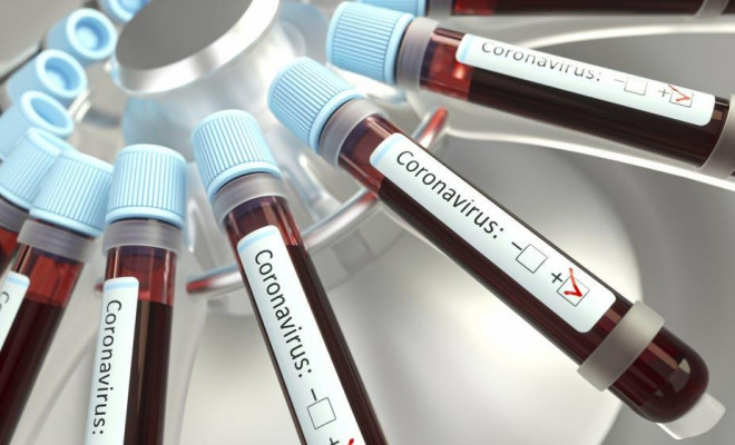 Mối liên quan giữa nhóm máu và nguy cơ mắc COVID-19 trầm trọng - 1