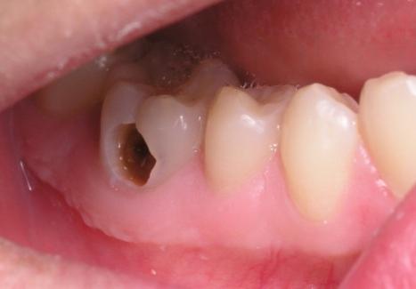 6 bài thuốc nam đơn giản, dễ kiếm chữa đau răng - 1