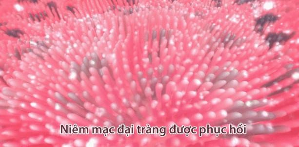 Bảo vệ đại tràng khỏi nỗi ám ảnh mang tên “Tất niên, tổng kết” - 3