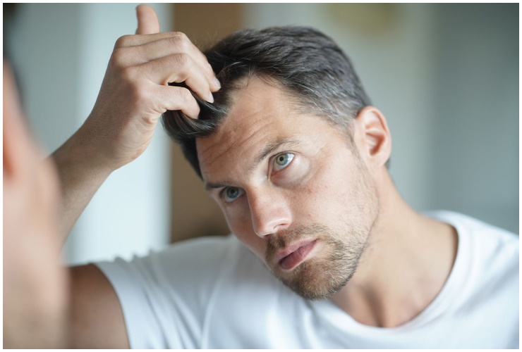 Bí quyết để đánh bật mọi nhược điểm, giúp đàn ông có mái tóc hấp dẫn hơn - 1