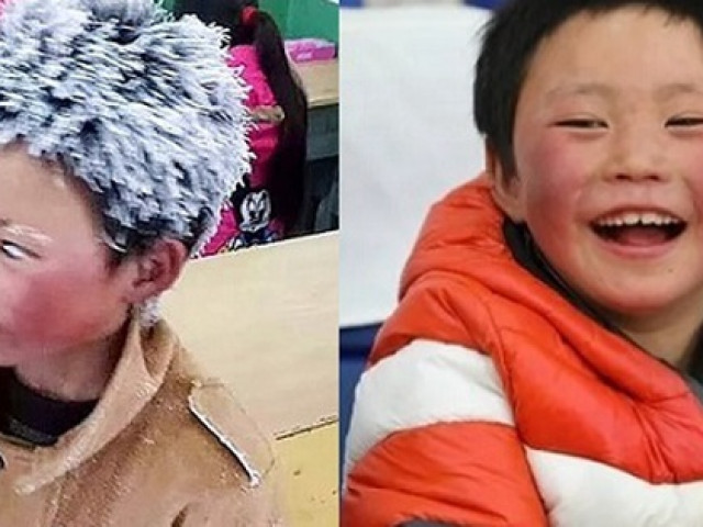 Cậu bé ”người tuyết” từng làm hàng triệu trái tim thổn thức giờ ra sao sau 4 năm đầy biến động?