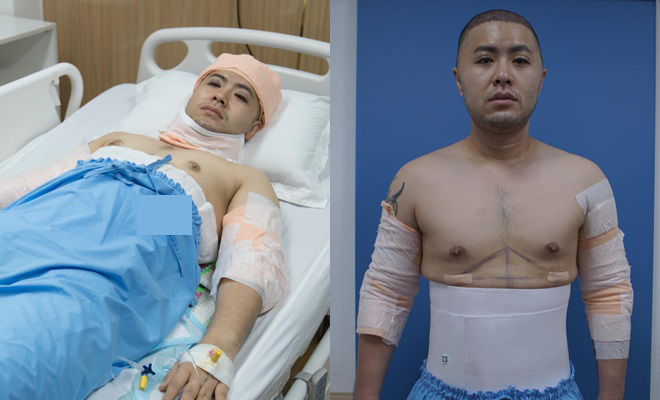 Diện mạo gây tranh cãi của Akira Phan sau 4 năm chi 300 triệu “dao kéo” toàn thân - 6