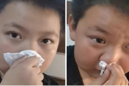 Bé trai nói bị dị ứng với mùi bài tập về nhà khiến cộng đồng mạng bật cười