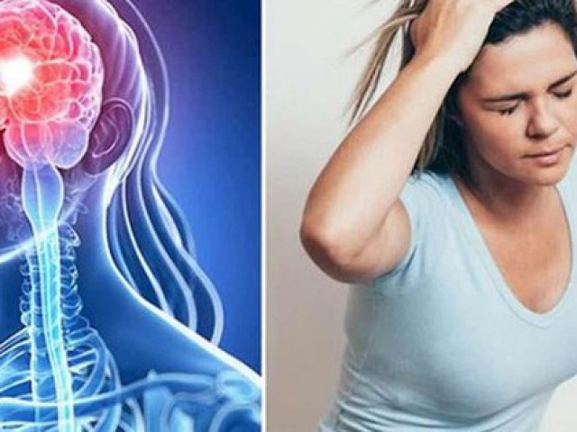 Cô gái 19 tuổi đột quỵ não sau cơn đau đầu đột ngột, chuyên gia khuyến cáo giới trẻ cần biết điều này để phòng bệnh cho chính mình