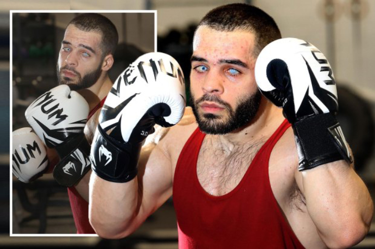 Chuyện kì lạ Boxing: Võ sĩ mù 2 mắt thượng đài với đối thủ sáng mắt - 1
