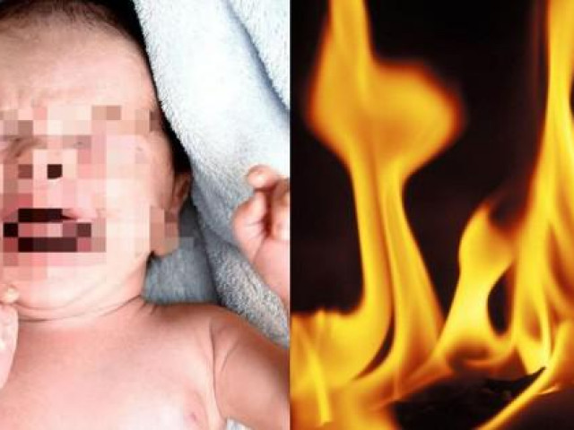 Hơ lửa quanh mặt ”đốt vía” cho trẻ sơ sinh: Vừa nguy hiểm vừa tiềm ẩn nhiều hệ lụy!