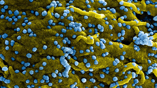 Bác sĩ BV Bạch Mai thông tin về loại virus khiến 9 người tử vong ở châu Phi - 1