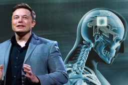 Elon Musk muốn cấy chip vào não người, vì sao Mỹ liên tục từ chối?