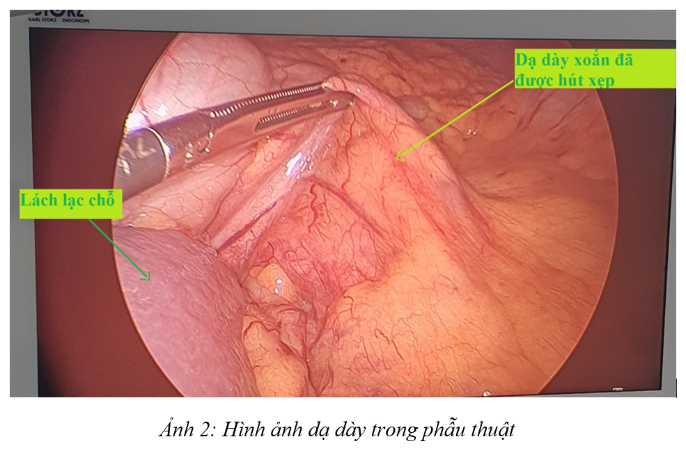 Nam thanh niên mắc bệnh hiếm gặp ở dạ dày, không thể nằm - 1