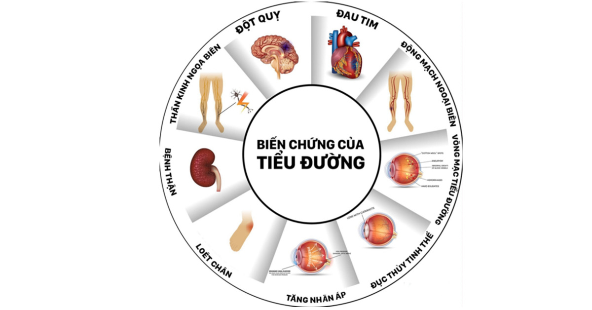 Diabetna giữ vững vị thế “Sản phẩm tin dùng số 1 Việt Nam cho người tiểu đường” - 1