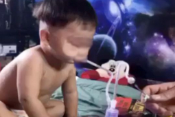 Lãnh đạo TP HCM chỉ đạo khẩn vụ bé trai 3 tuổi nghi bị ép hút ma túy