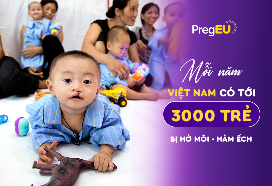 PregEU chung tay cùng Operation Smile Vietnam gây quỹ từ thiện cho trẻ hở môi, hàm ếch - 1