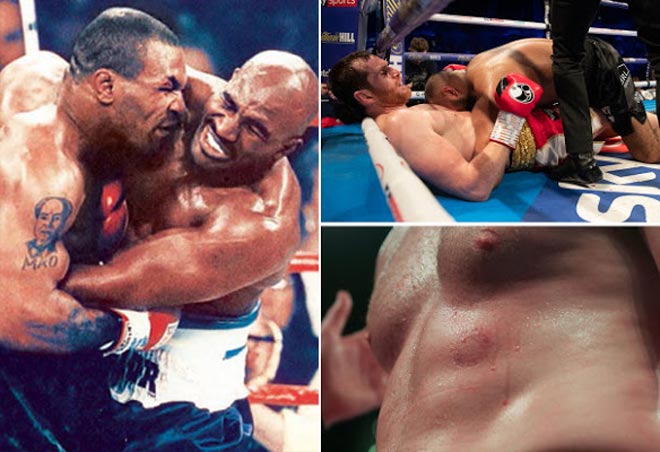 "Ác chiêu cắn" của Mike Tyson tái hiện sau 22 năm: Ôm hận thiên thu - 1